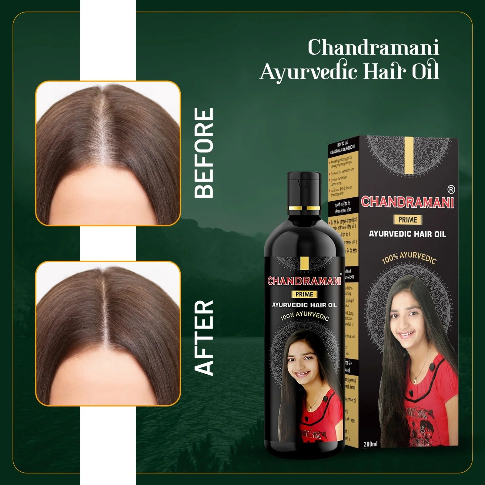 Chandramani Prime Ayurvedic Hair Oil- 200 ml